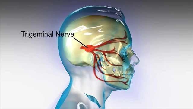 ABOUT TRIGEMINAL NEURALGIA AND ITS HOMOEOPATHIC  REMEDIES