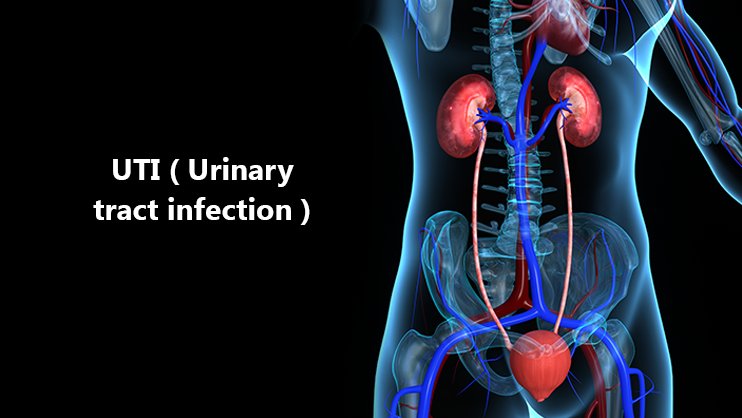URINARY TRACT INFECTION AND ITS HOMOEOPATHIC MEDICINE