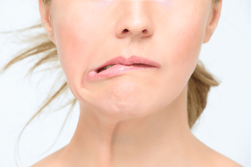 ABOUT BELLS PALSY AND ITS HOMOEOPATHIC  REMEDIES