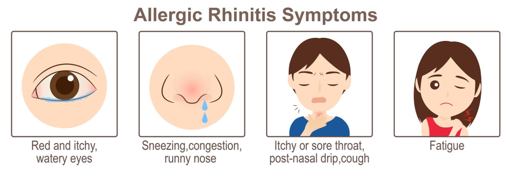 Allergic Rhinitis and its Homoeopathic Medicine