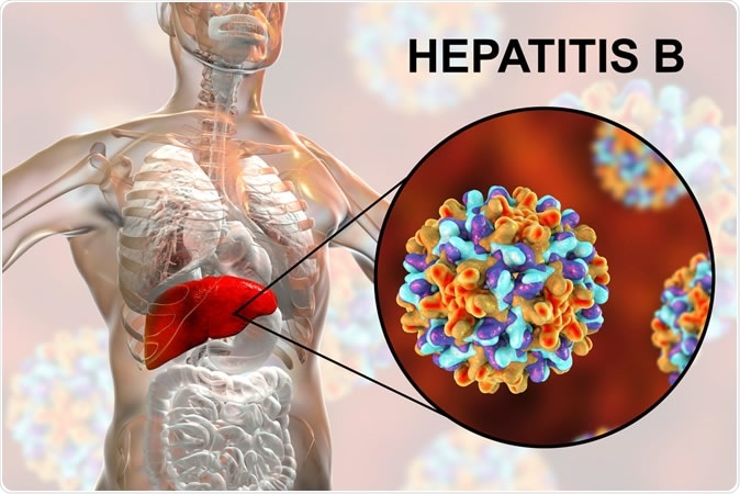 Hepatitis B and its Homoeopathic Medicine