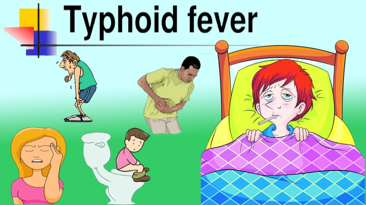 Typhoid fever and its Homoeopathic Medicine