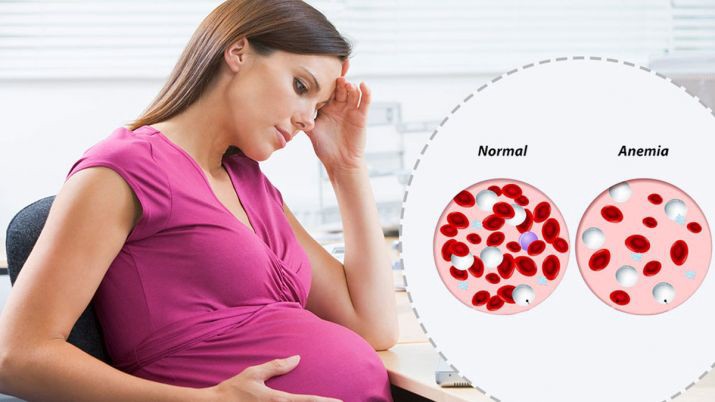 ANAEMIA DURING PREGNANCY AND ITS HOMOEOPATHIC MEDICINE