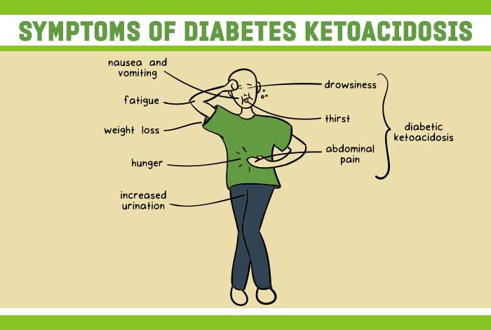 DIABETIC KETOACIDOSIS AND ITS HOMOEOPATHIC MEDICINE