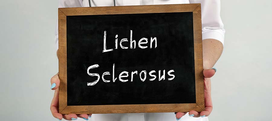 Homoeopathic Medicine For Lichen Sclerosis