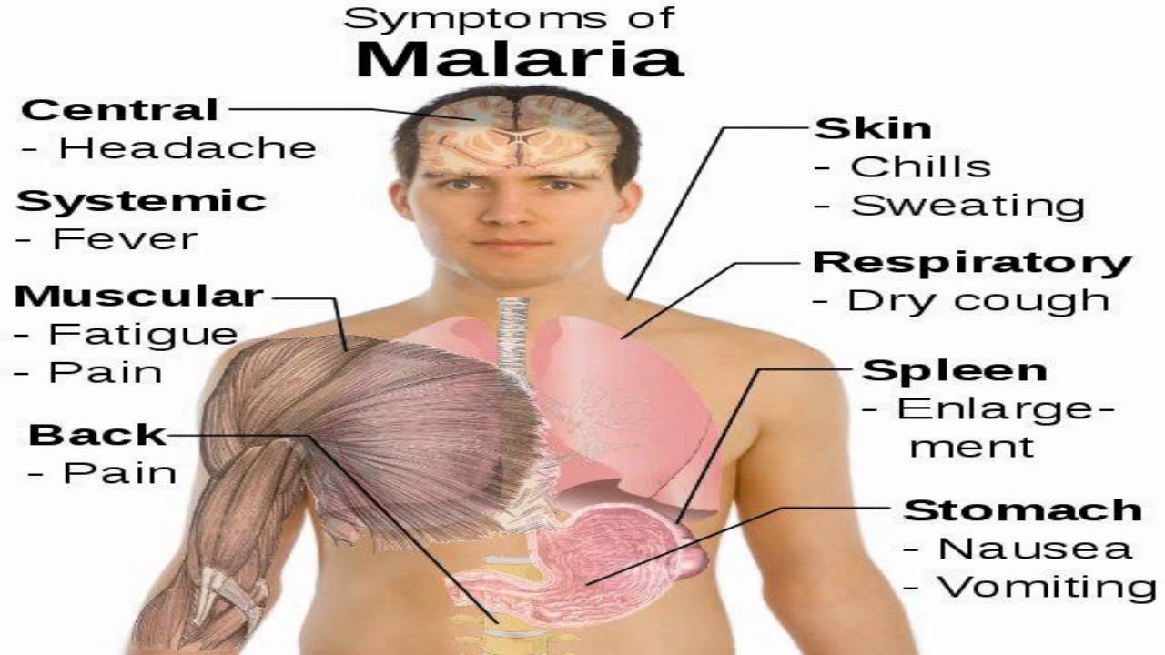 Malaria and its Homoeopathic Medicine